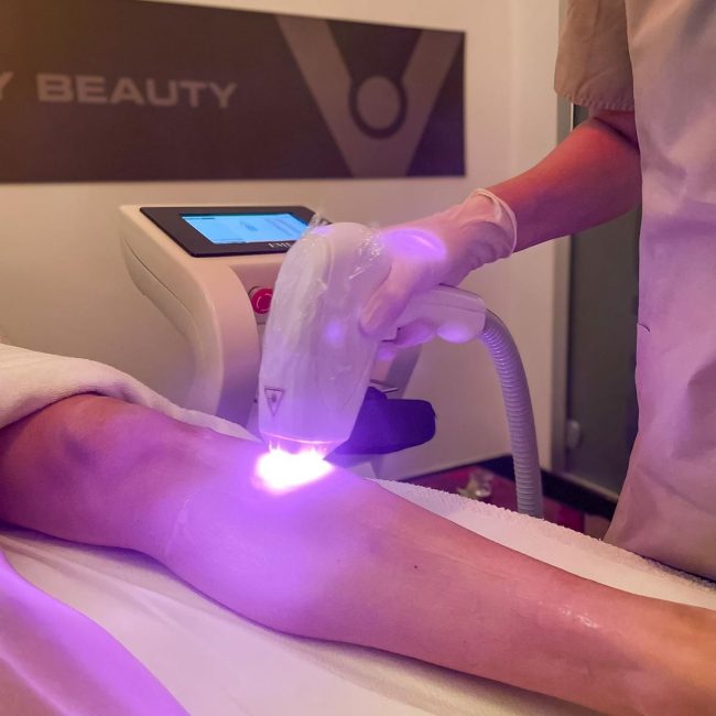 EPILAZIONE LASER CORPO DONNA
