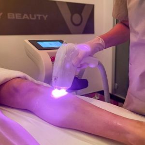EPILAZIONE LASER CORPO DONNA