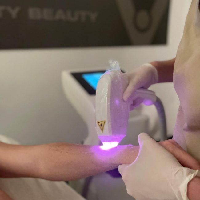 EPILAZIONE LASER CORPO UOMO