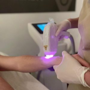 EPILAZIONE LASER CORPO UOMO