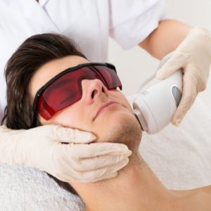 EPILAZIONE LASER VISO UOMO